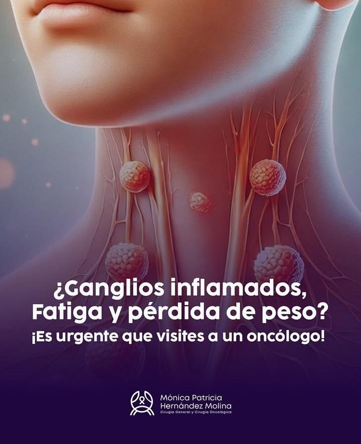 Infografía: ganglios inflamados, fatiga y pérdida de peso como señales para acudir con un oncólogo